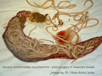 Dog Worms in Intestine
